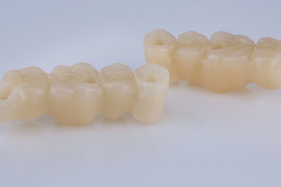 Jak tymczasowo zamaskować brak zęba